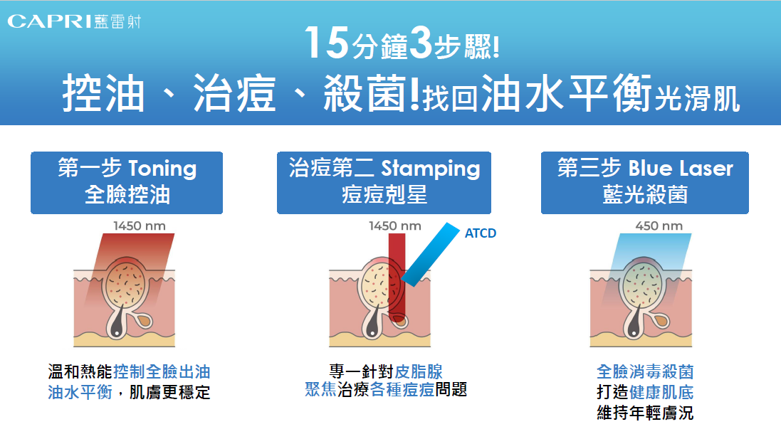 彰化藍雷射步驟